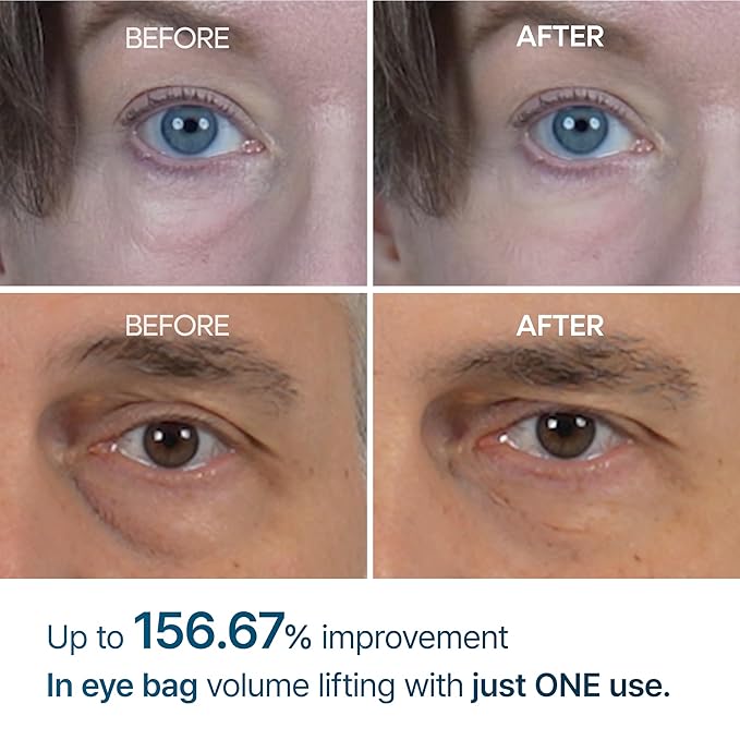 👁️✨ Dr Melaxin Eyephalt Eye Cream | Reduce Eye Bags, Dark Circles & Fine Lines 💙